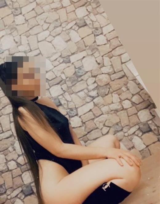 Genç kabarcıklı escort modeli Astrid Rita (25 yaşında) Yüzünde biten Manavgat